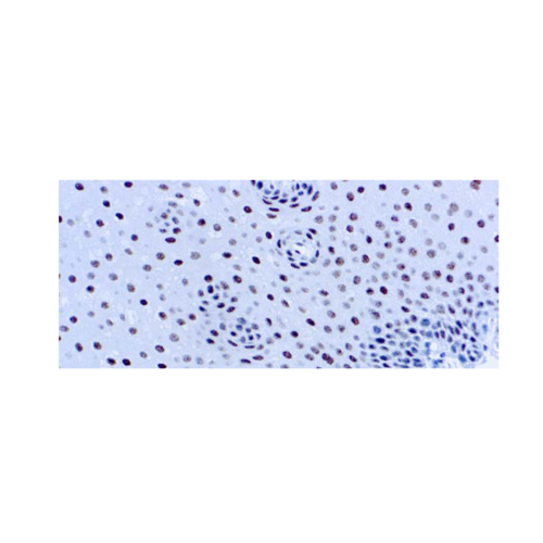 ERCC1