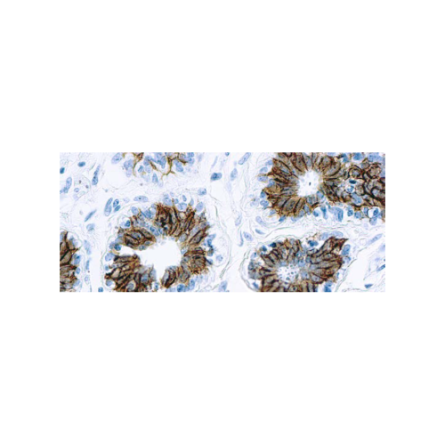Epithelial Antigen (Ber-EP4)