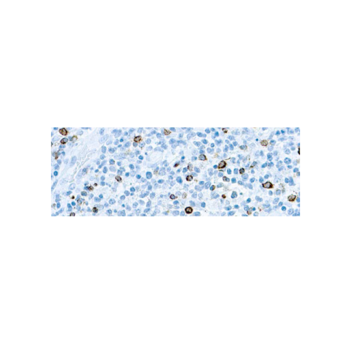 Epstein-Barr Virus (EBV) Epstein-Barr Virus (EBV)