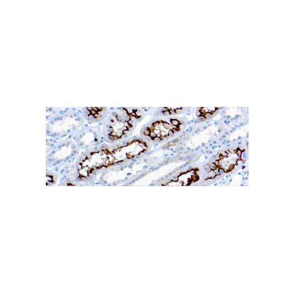 Ezrinp81Cytovillin Ezrinp81Cytovillin