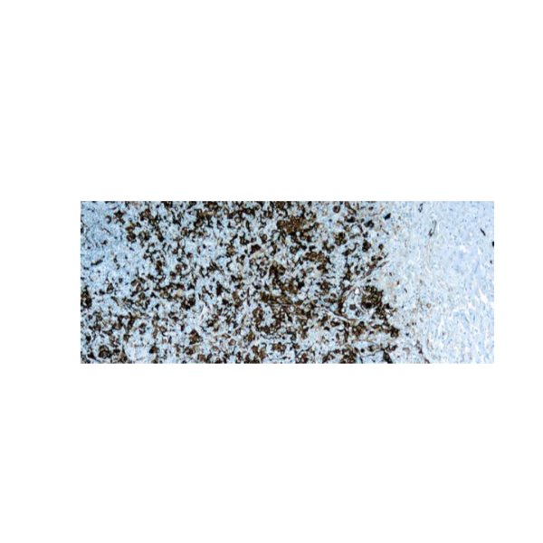 Fascin-1
