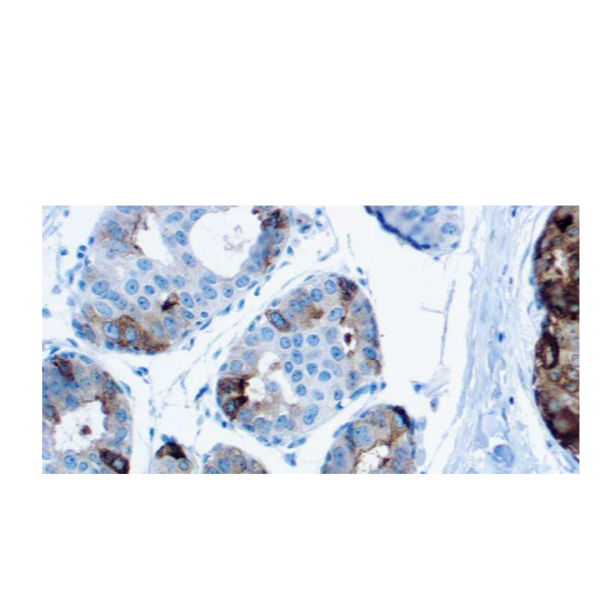 GCDFP-15