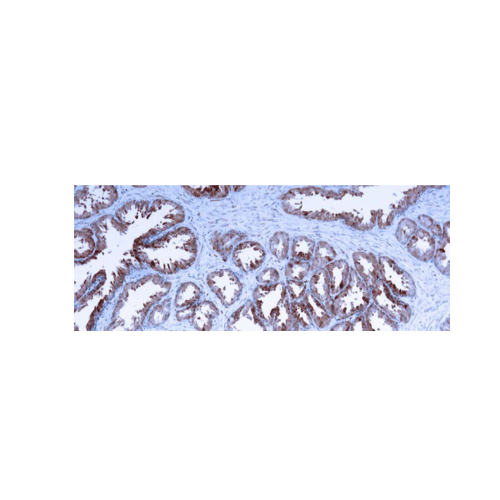 Galectin-3 Galectin-3
