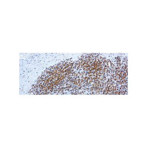Glypican-3 (GPC3)