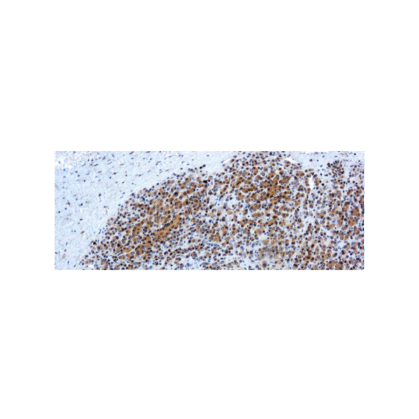Glypican-3 (GPC3) Glypican-3 (GPC3)