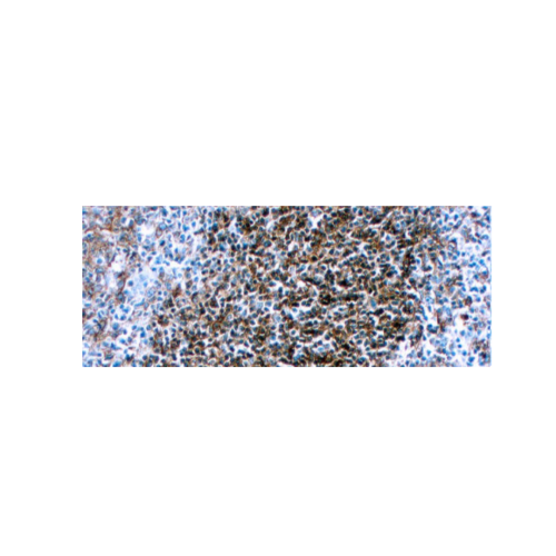 HLA-DR (β chain of DP, DQ & DR) HLA-DR (β chain of DP, DQ & DR)