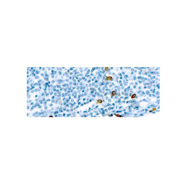 Mast Cell Chymase