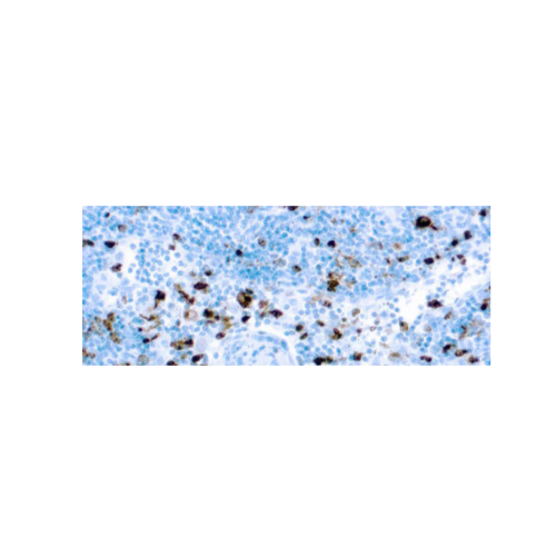 Mieloperoxidasa Mieloperoxidasa