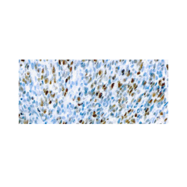 MyoD1