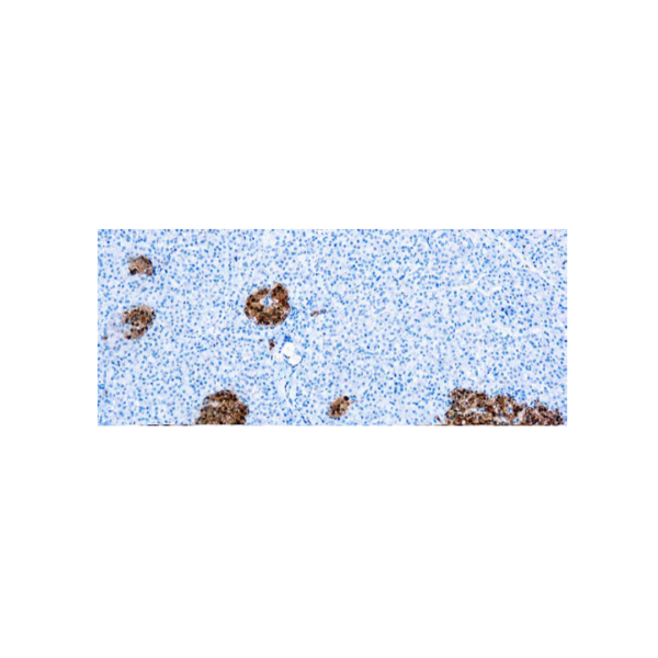 Neuron Specific Enolase, NSE