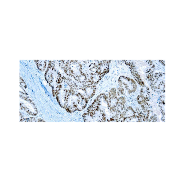 PMS2 Anticuerpo monoclonal de ratón PMS2
