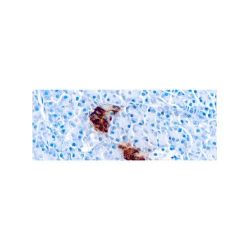 Pancreatic Polypeptide
