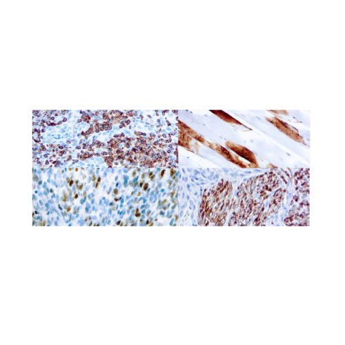 Panel muscular