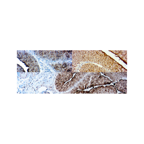 Panel vejiga