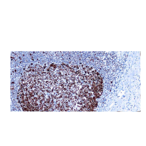 Proliferating Cell Nuclear Antigen Proliferating Cell Nuclear Antigen