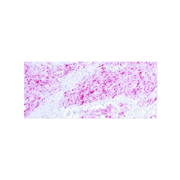 S-100 Protein