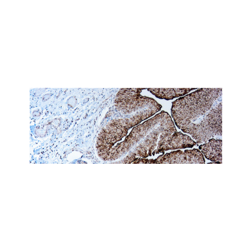 Uroplakin III