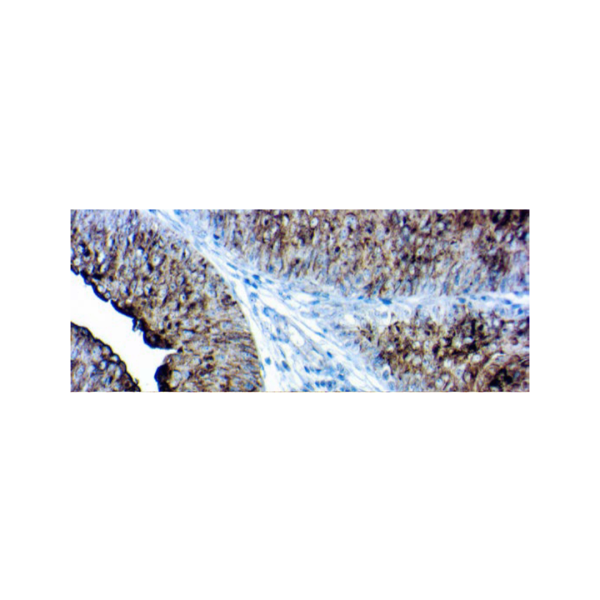 Uroplakin IIIII Cocktail